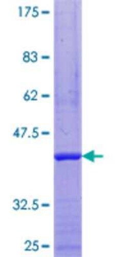 Novus Biologicals Recombinant Human RRN3 GST (N-Term) Protein 10 &mu;g | Buy Online | Novus Biologicals&trade; | Fisher Scientific