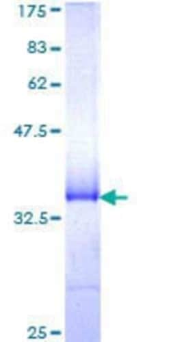 Novus Biologicals Recombinant Human MARCH5 GST (N-Term) Protein 10 &mu;g | Buy Online | Novus Biologicals&trade; | Fisher Scientific
