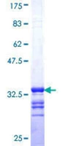 Novus Biologicals Recombinant Human SLC6A20 GST (N-Term) Protein 25 &mu;g | Buy Online | Novus Biologicals&trade; | Fisher Scientific