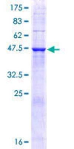 Novus Biologicals Recombinant Human TMED9 GST (N-Term) Protein 10 &mu;g | Buy Online | Novus Biologicals&trade; | Fisher Scientific