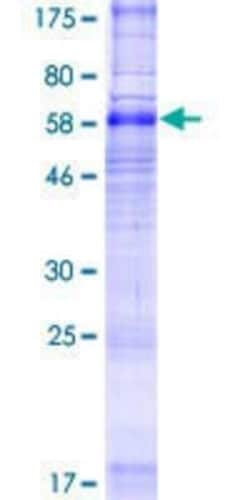 Novus Biologicals Recombinant Human SLC35F2 GST (N-Term) Protein 25 &mu;g | Buy Online | Novus Biologicals&trade; | Fisher Scientific