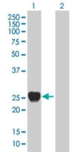 Novus Biologicals RAB39 293T Cell Transient Overexpression Lysate 0.1 mL | Buy Online | Novus Biologicals&trade; | Fisher Scientific