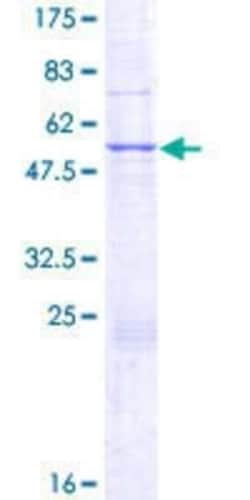 Novus Biologicals Recombinant Human mpp8 GST (N-Term) Protein 10 &mu;g | Buy Online | Novus Biologicals&trade; | Fisher Scientific