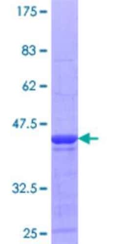 Novus Biologicals Recombinant Human mpp8 GST (N-Term) Protein 10 &mu;g | Buy Online | Novus Biologicals&trade; | Fisher Scientific