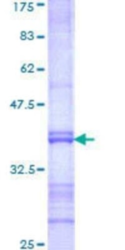 Novus Biologicals Recombinant Human Pet1 GST (N-Term) Protein 25 &mu;g | Buy Online | Novus Biologicals&trade; | Fisher Scientific