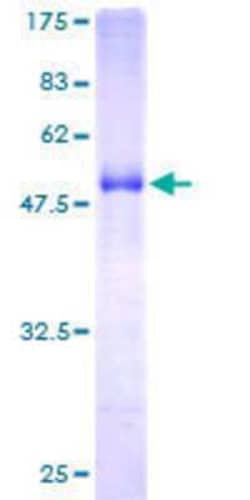 Novus Biologicals Recombinant Human EPDR1 GST (N-Term) Protein 25 &mu;g | Buy Online | Novus Biologicals&trade; | Fisher Scientific