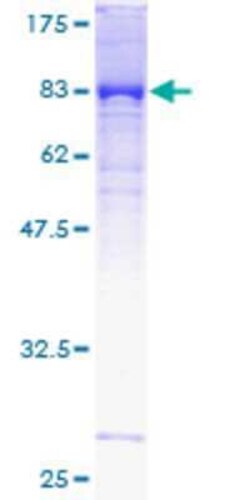 Novus Biologicals Recombinant Human KLHDC4 GST (N-Term) Protein 2 &mu;g | Buy Online | Novus Biologicals&trade; | Fisher Scientific