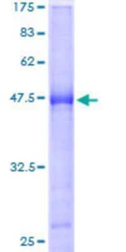 Novus Biologicals Recombinant Human BTG4 GST (N-Term) Protein 25 &mu;g | Buy Online | Novus Biologicals&trade; | Fisher Scientific