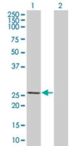Novus Biologicals BTG4 293T Cell Transient Overexpression Lysate 0.1 mL | Buy Online | Novus Biologicals&trade; | Fisher Scientific