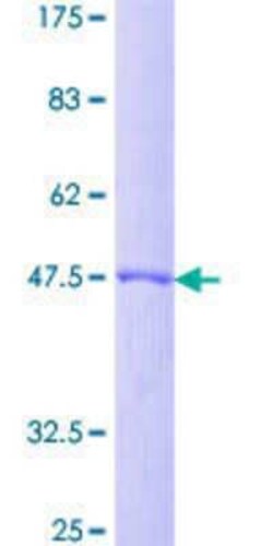 Novus Biologicals Recombinant Human DIRAS2 GST (N-Term) Protein 25 &mu;g | Buy Online | Novus Biologicals&trade; | Fisher Scientific
