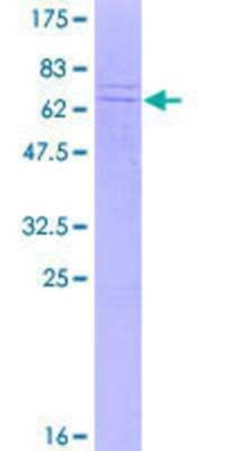 Novus Biologicals Recombinant Human DNAJB12 GST (N-Term) Protein 2 &mu;g | Buy Online | Novus Biologicals&trade; | Fisher Scientific