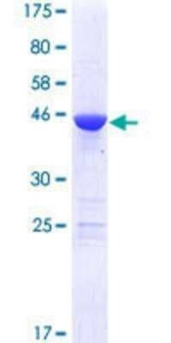 Novus Biologicals Recombinant Human MED18 GST (N-Term) Protein 25 &mu;g | Buy Online | Novus Biologicals&trade; | Fisher Scientific