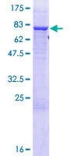 Novus Biologicals Recombinant Human TRIT1 GST (N-Term) Protein 25 &mu;g | Buy Online | Novus Biologicals&trade; | Fisher Scientific