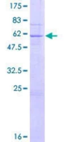Novus Biologicals Recombinant Human QPCTL GST (N-Term) Protein 2 &mu;g | Buy Online | Novus Biologicals&trade; | Fisher Scientific