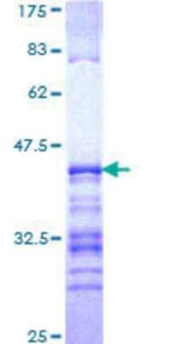 Novus Biologicals Recombinant Human p66 alpha GST (N-Term) Protein 25 &mu;g | Buy Online | Novus Biologicals&trade; | Fisher Scientific