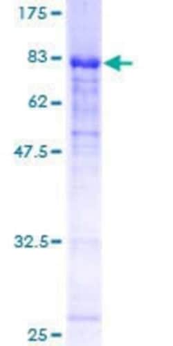 Novus Biologicals Recombinant Human ERCC6L GST (N-Term) Protein 25 &mu;g | Buy Online | Novus Biologicals&trade; | Fisher Scientific