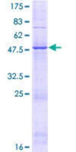 Novus Biologicals Recombinant Human GIN-1 GST (N-Term) Protein 10 &mu;g | Buy Online | Novus Biologicals&trade; | Fisher Scientific