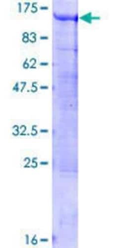 Novus Biologicals&trade;&nbsp;Recombinant Human Breast carcinoma amplified sequence 3 GST (N-Term) Protein