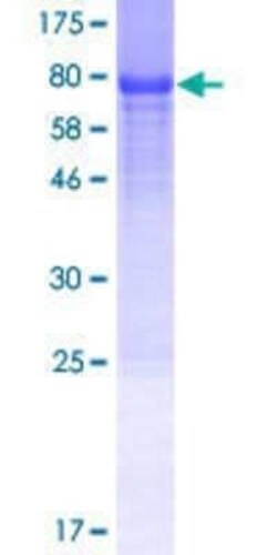 Novus Biologicals Recombinant Human GDAP2 GST (N-Term) Protein 25 &mu;g | Buy Online | Novus Biologicals&trade; | Fisher Scientific