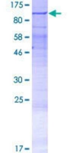 Novus Biologicals Recombinant Human LRRC49 GST (N-Term) Protein 2 &mu;g | Buy Online | Novus Biologicals&trade; | Fisher Scientific