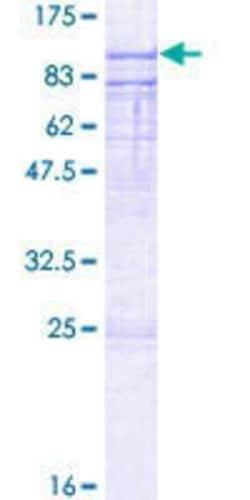 Novus Biologicals Recombinant Human ESRP1 GST (N-Term) Protein 2 &mu;g | Buy Online | Novus Biologicals&trade; | Fisher Scientific