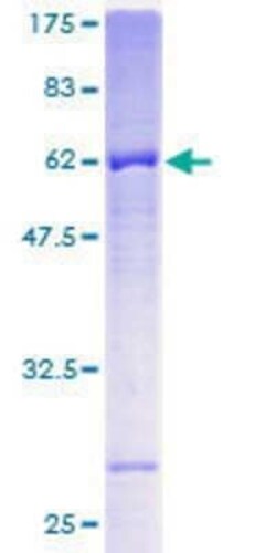 Novus Biologicals Recombinant Human FbxL12 GST (N-Term) Protein 25 &mu;g | Buy Online | Novus Biologicals&trade; | Fisher Scientific