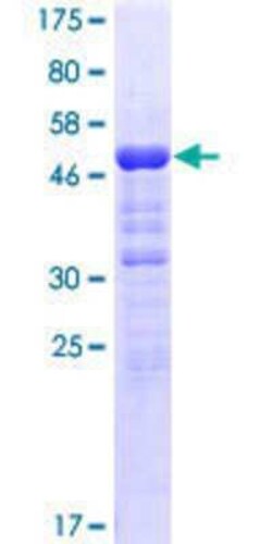 Novus Biologicals Recombinant Human ANKRD49 GST (N-Term) Protein 25 &mu;g | Buy Online | Novus Biologicals&trade; | Fisher Scientific