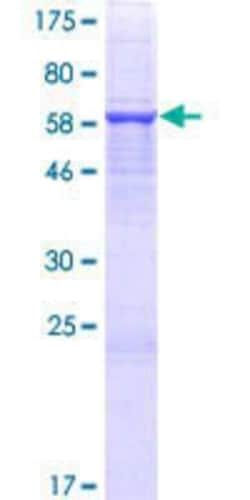 Novus Biologicals Recombinant Human FAM46C GST (N-Term) Protein 10 &mu;g | Buy Online | Novus Biologicals&trade; | Fisher Scientific