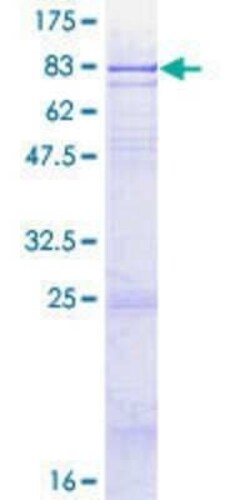 Novus Biologicals Recombinant Human GDPD2 GST (N-Term) Protein 2 &mu;g | Buy Online | Novus Biologicals&trade; | Fisher Scientific