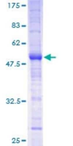 Novus Biologicals Recombinant Human MS4A12 GST (N-Term) Protein 10 &mu;g | Buy Online | Novus Biologicals&trade; | Fisher Scientific