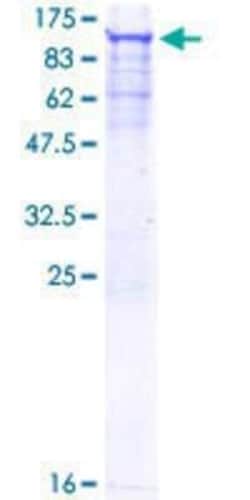 Novus Biologicals Recombinant Human SNRK GST (N-Term) Protein 10 &mu;g | Buy Online | Novus Biologicals&trade; | Fisher Scientific