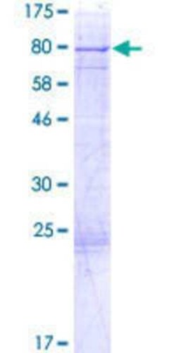 Novus Biologicals Recombinant Human EPS8L1 GST (N-Term) Protein 2 &mu;g | Buy Online | Novus Biologicals&trade; | Fisher Scientific