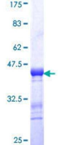 Novus Biologicals Recombinant Human EPS8L1 GST (N-Term) Protein 25 &mu;g | Buy Online | Novus Biologicals&trade; | Fisher Scientific