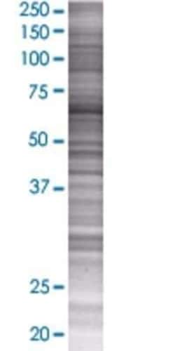 Novus Biologicals EPS8L1 293T Cell Transient Overexpression Lysate 0.1 mL | Buy Online | Novus Biologicals&trade; | Fisher Scientific