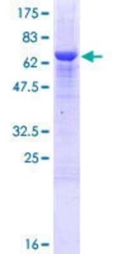Novus Biologicals Recombinant Human ZCCHC2 GST (N-Term) Protein 25 &mu;g | Buy Online | Novus Biologicals&trade; | Fisher Scientific
