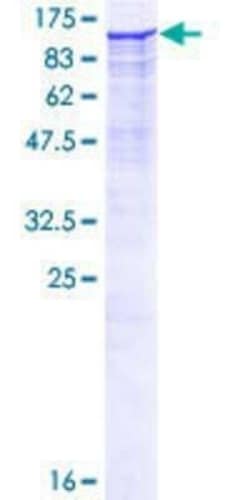 Novus Biologicals Recombinant Human DPP8 GST (N-Term) Protein 10 &mu;g | Buy Online | Novus Biologicals&trade; | Fisher Scientific