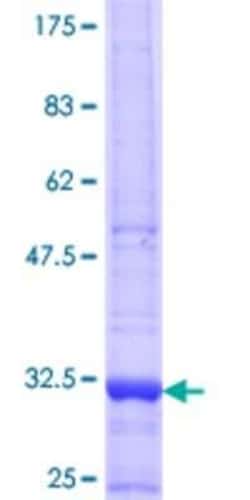 Novus Biologicals Recombinant Human DPP8 GST (N-Term) Protein 25 &mu;g | Buy Online | Novus Biologicals&trade; | Fisher Scientific