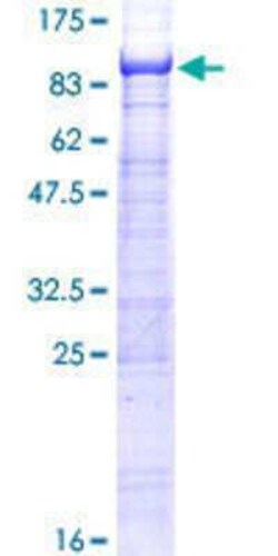 Novus Biologicals Recombinant Human ST7L GST (N-Term) Protein 10 &mu;g | Buy Online | Novus Biologicals&trade; | Fisher Scientific