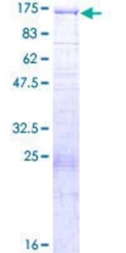 Novus Biologicals Recombinant Human BCOR GST (N-Term) Protein 2 &mu;g | Buy Online | Novus Biologicals&trade; | Fisher Scientific