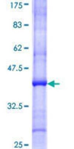 Novus Biologicals Recombinant Human NCAPG2 GST (N-Term) Protein 10 &mu;g | Buy Online | Novus Biologicals&trade; | Fisher Scientific