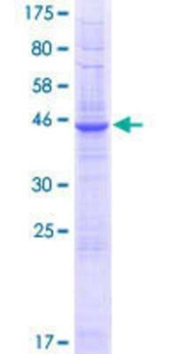 Novus Biologicals Recombinant Human PQLC2 GST (N-Term) Protein 25 &mu;g | Buy Online | Novus Biologicals&trade; | Fisher Scientific