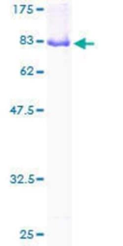 Novus Biologicals Recombinant Human PXK GST (N-Term) Protein 10 &mu;g | Buy Online | Novus Biologicals&trade; | Fisher Scientific