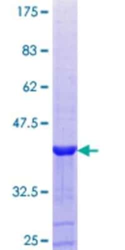 Novus Biologicals Recombinant Human PXK GST (N-Term) Protein 10 &mu;g | Buy Online | Novus Biologicals&trade; | Fisher Scientific