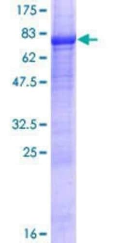 Novus Biologicals Recombinant Human LAX1 GST (N-Term) Protein 25 &mu;g | Buy Online | Novus Biologicals&trade; | Fisher Scientific