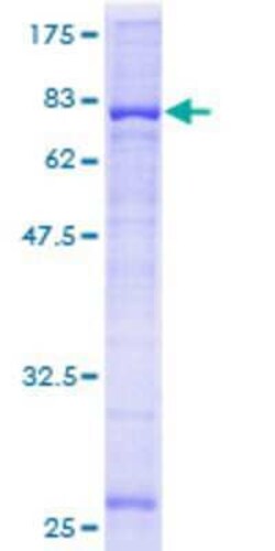 Novus Biologicals Recombinant Human CYP2W1 GST (N-Term) Protein 2 &mu;g | Buy Online | Novus Biologicals&trade; | Fisher Scientific