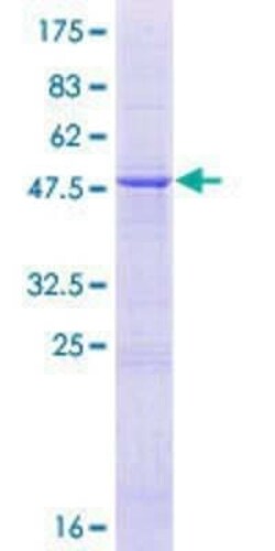 Novus Biologicals Recombinant Human HEATR2 GST (N-Term) Protein 25 &mu;g | Buy Online | Novus Biologicals&trade; | Fisher Scientific