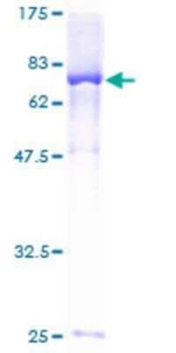 Novus Biologicals Recombinant Human DUS2L GST (N-Term) Protein 25 &mu;g | Buy Online | Novus Biologicals&trade; | Fisher Scientific