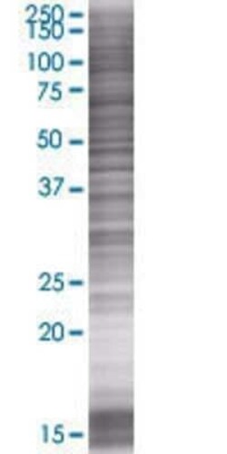 Novus Biologicals RAIN 293T Cell Transient Overexpression Lysate 0.1 mL | Buy Online | Novus Biologicals&trade; | Fisher Scientific