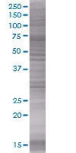 Novus Biologicals ZNF434 293T Cell Transient Overexpression Lysate 0.1 mL | Buy Online | Novus Biologicals&trade; | Fisher Scientific
