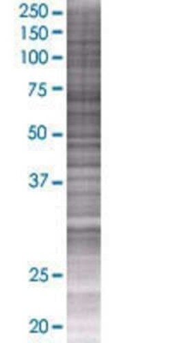 Novus Biologicals ZNF434 293T Cell Transient Overexpression Lysate 0.1 mL | Buy Online | Novus Biologicals&trade; | Fisher Scientific
